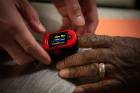 Among the health screenings that students conducted was a pulse oximetry, performed with the device shown here, called a “pulse ox,” that measures the amount of oxygen in a person’s blood.