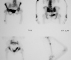 Zoom image: Radiological image
