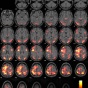 Mosaic of brain scans. 