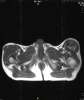 Radiological image.