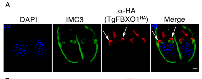 Zoom image: This figure is from Ira Blader&rsquo;s lab; it shows the 3D arrangement of proteins and membranes of Toxoplasma gondii parasites undergoing replication. This image was acquired on the Leica SP8 STED super-resolution confocal microscope. Panels A through C compare the three-dimensional locations of 3 different components of the parasite (IMC3, ISP1 and a-myc) to the location of the FBOX01 protein.&nbsp; The volume rendered image shows that FBOX01 protein is an initiation site for these other components. F-box proteins are known to control cell cycle and membrane trafficking and thus are important in the replication of this parasite which is the cause of the disease, toxoplasmosis. 