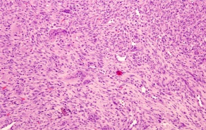 Image of stained tissue. 