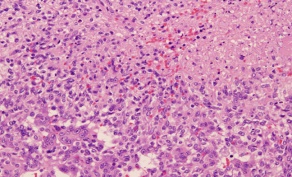 Image of stained tissue. 