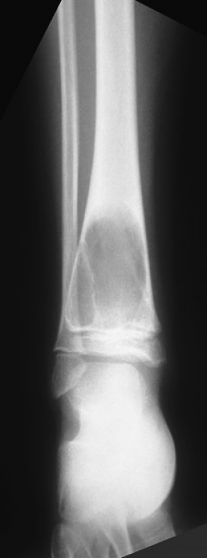 x-ray. 