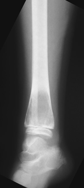 x-ray. 