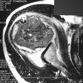 X-ray image. 