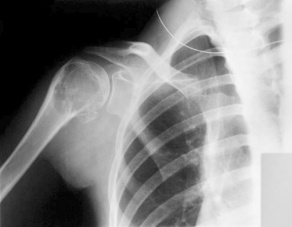 X-ray image. 