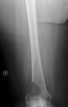 Zoom image: Radiological image