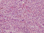 Zoom image: Cell stain