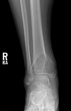 Zoom image: Radiological image