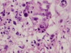 Zoom image: Cell stain