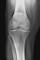 Zoom image: Radiological image