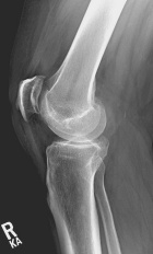 Zoom image: Radiological image