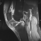 Zoom image: Radiological image