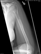 Zoom image: Radiological image