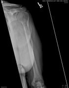 Zoom image: Radiological image