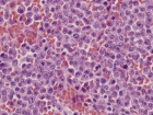 Zoom image: Cell stain