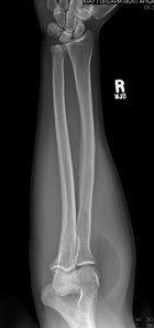 Zoom image: Radiological image