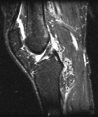 Zoom image: Radiological image