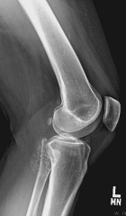 Zoom image: Radiological image