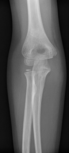 Zoom image: Radiological image