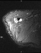 Zoom image: Radiological image