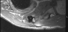 Zoom image: Radiological image