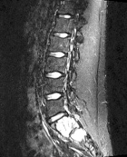 Zoom image: Radiological image