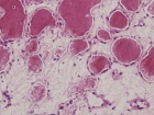 Zoom image: Cell stain