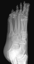 Zoom image: Radiological image