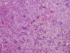 Zoom image: Cell stain