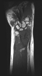 Zoom image: Radiological image