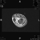 Zoom image: Radiological image