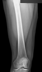 Zoom image: Radiological image