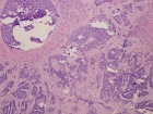 Zoom image: Cell stain