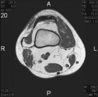 Zoom image: Radiological image