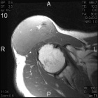 Zoom image: Radiological image