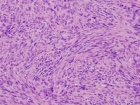 Zoom image: Cell stain