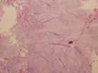 Zoom image: Cell stain