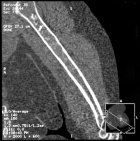Zoom image: Radiological image
