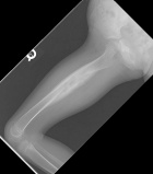 Zoom image: Radiological image