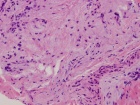 Zoom image: Cell stain