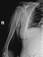 Zoom image: Radiological image