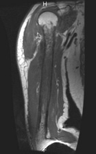Zoom image: Radiological image