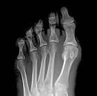 Zoom image: Radiological image