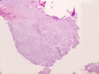 Zoom image: Cell stain