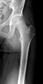 Zoom image: Radiological image