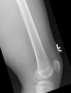 Zoom image: Radiological image