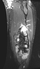 Zoom image: Radiological image