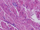 Zoom image: Cell stain